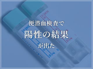 腹痛、胃痛、吐き気、胸やけ、食欲不振などお腹の症状