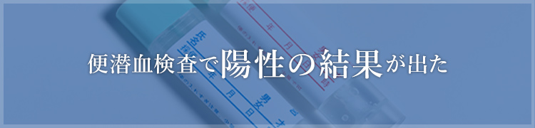 腹痛、胃痛、吐き気、胸やけ、食欲不振などお腹の症状