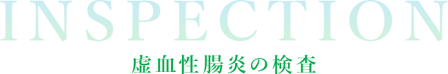 INSPECTION 虚血性腸炎の検査
